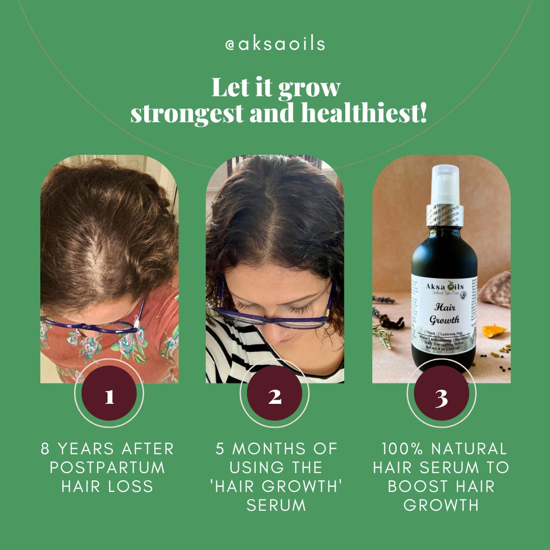 Ayurvedic Hair Growth Oil for Healthier, Stronger & Thicker Hair | Herbal Scalp Stimulant for Hair Lose, Dry and Itchy Scalp, Vegan - AksaOils