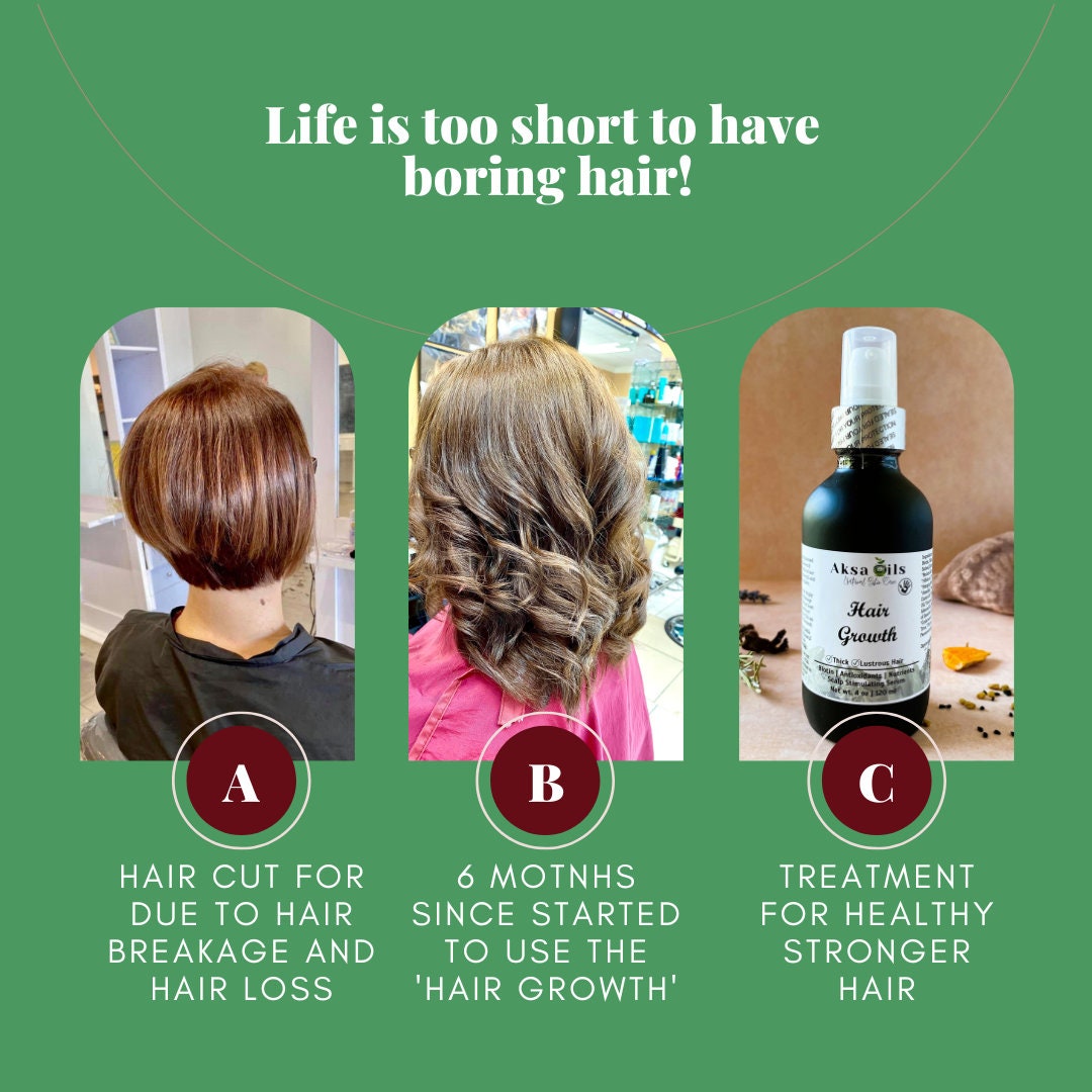 Ayurvedic Hair Growth Oil for Healthier, Stronger & Thicker Hair | Herbal Scalp Stimulant for Hair Lose, Dry and Itchy Scalp, Vegan - AksaOils